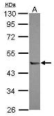 Anti-PI16 antibody used in Western Blot (WB). GTX121554