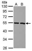 Anti-PI16 antibody used in Western Blot (WB). GTX121555