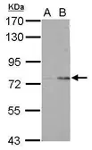 Anti-POLR3E antibody used in Western Blot (WB). GTX121558