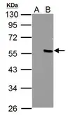 Anti-PPP4R2 antibody used in Western Blot (WB). GTX121559