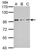 Anti-RASA4 antibody used in Western Blot (WB). GTX121563