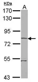Anti-RHOBTB1 antibody used in Western Blot (WB). GTX121574