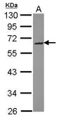 Anti-SMOC2 antibody used in Western Blot (WB). GTX121583