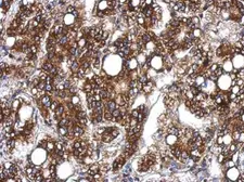 Anti-Sts1 antibody used in IHC (Paraffin sections) (IHC-P). GTX121603