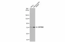 Anti-ZBTB20 antibody used in Western Blot (WB). GTX121616
