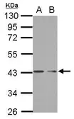 Anti-PHF7 antibody used in Western Blot (WB). GTX121618
