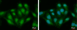 Anti-TRAK2 antibody used in Immunocytochemistry/ Immunofluorescence (ICC/IF). GTX121628