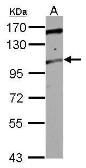 Anti-TRAK2 antibody used in Western Blot (WB). GTX121628
