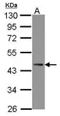 Anti-ZNF302 antibody used in Western Blot (WB). GTX121642