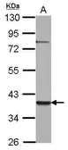 Anti-ZNF302 antibody used in Western Blot (WB). GTX121643