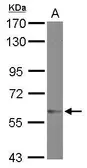 Anti-ZNF329 antibody [C1C3] used in Western Blot (WB). GTX121645