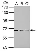 Anti-ZNF416 antibody [N1C2] used in Western Blot (WB). GTX121646