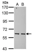 Anti-KIAA0391 antibody used in Western Blot (WB). GTX121658