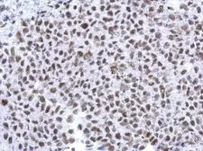 Anti-Histone H1.4 antibody [N1N2], N-term used in IHC (Paraffin sections) (IHC-P). GTX121670