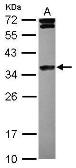 Anti-Histone H1.4 antibody [N1N2], N-term used in Western Blot (WB). GTX121670