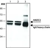 Anti-HDAC2 antibody [HDAC2-62] used in Immunoprecipitation (IP). GTX12169