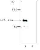 Anti-HDAC7 antibody used in Immunoprecipitation (IP). GTX12174