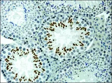 Anti-Histone H3K9ac (Acetyl Lys9) antibody used in IHC (Paraffin sections) (IHC-P). GTX12178