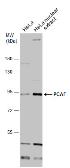 Anti-PCAF antibody used in Western Blot (WB). GTX12188