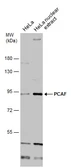 Anti-PCAF antibody used in Western Blot (WB). GTX12188