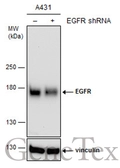 Anti-EGFR antibody [N1-2], N-term used in Western Blot (WB). GTX121919