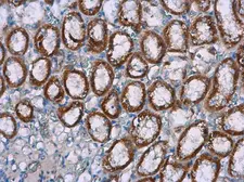 Anti-NOX4 antibody [N3C3] used in IHC (Paraffin sections) (IHC-P). GTX121929