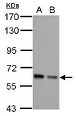 Anti-AKT antibody [N3C2], Internal used in Western Blot (WB). GTX121937