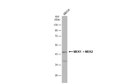Anti-MEK1 + MEK2 antibody used in Western Blot (WB). GTX121942