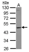 Anti-MEK1 + MEK2 antibody [N2C2], Internal used in Western Blot (WB). GTX121943