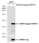 Anti-SMYD3 antibody used in Western Blot (WB). GTX121945