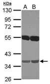Anti-EMB antibody [N1C1] used in Western Blot (WB). GTX121953