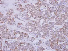 Anti-GTDC1 antibody used in IHC (Paraffin sections) (IHC-P). GTX121961