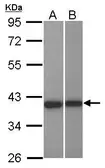 Anti-LRRC23 antibody [N1C2-2] used in Western Blot (WB). GTX121977