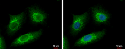Anti-METTL6 antibody [N1C3] used in Immunocytochemistry/ Immunofluorescence (ICC/IF). GTX121980