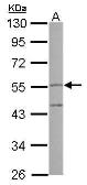 Anti-PI16 antibody [N1N3] used in Western Blot (WB). GTX121996
