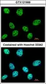 Anti-POLR3E antibody used in Immunocytochemistry/ Immunofluorescence (ICC/IF). GTX121999