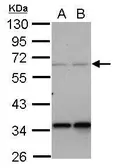 Anti-PPP4R2 antibody used in Western Blot (WB). GTX122000