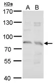 Anti-Syntrophin gamma 2 antibody used in Western Blot (WB). GTX122025