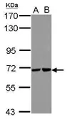 Anti-Sts1 antibody [N2C1], Internal used in Western Blot (WB). GTX122044