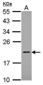 Anti-MRPL21 antibody [N1C3] used in Western Blot (WB). GTX122070