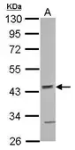 Anti-ACTR10 antibody [N3C3] used in Western Blot (WB). GTX122082