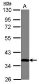 Anti-ZNF177 antibody [N3C3] used in Western Blot (WB). GTX122093