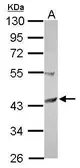 Anti-SCCPDH antibody [N1C1] used in Western Blot (WB). GTX122100