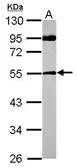 Anti-SPAG8 antibody used in Western Blot (WB). GTX122115