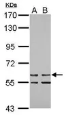 Anti-ZNF419 antibody [N1N3] used in Western Blot (WB). GTX122141