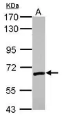 Anti-ZNF419 antibody [N2C2], Internal used in Western Blot (WB). GTX122142
