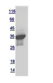 Drosophila CG1458 protein, GST tag. GTX122151-pro