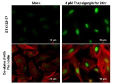 Anti-XBP1 antibody used in Immunocytochemistry/ Immunofluorescence (ICC/IF). GTX122157