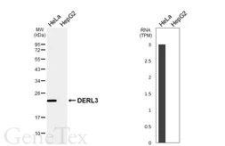 Anti-DERL3 antibody [N3C2], Internal used in Western Blot (WB). GTX122163