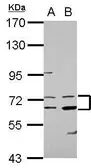 Anti-COL4A3BP antibody [N1N2], N-term used in Western Blot (WB). GTX122166
